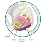 Medical illustration of the pelvic floor including the bladder, uterus, pelvic floor muscles, and rectum.