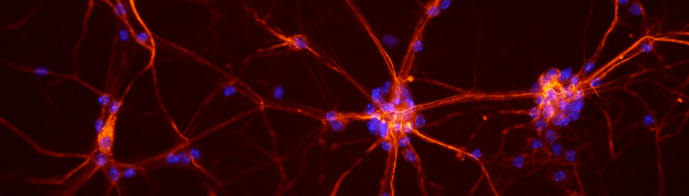 Fluorescent neurons from a mouse spinal cord.
