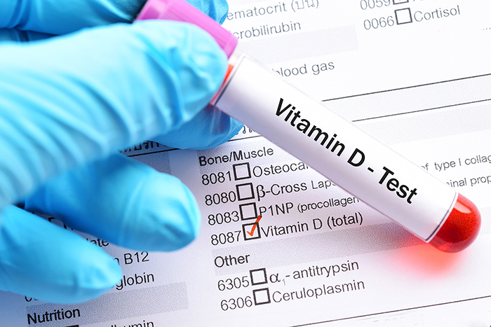 A gloved hand holds a test tube marked “Vitamin D Test,” in front of a check list of medical tests, with the box for “Vitamin D Test” checked.