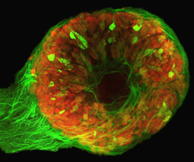 A donut-shaped mass of red cells is dotted with green against a black background. The green fibers are bunched along the lower left edge.