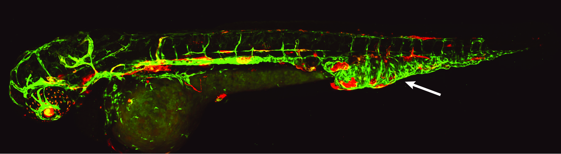 Zebrafish with fluorescently labeled lymphatic and blood vessels and vascular malformation in the tail.
