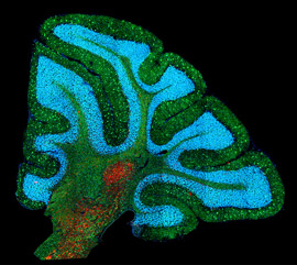 Mouse brain with Niemann-Pick disease type C1