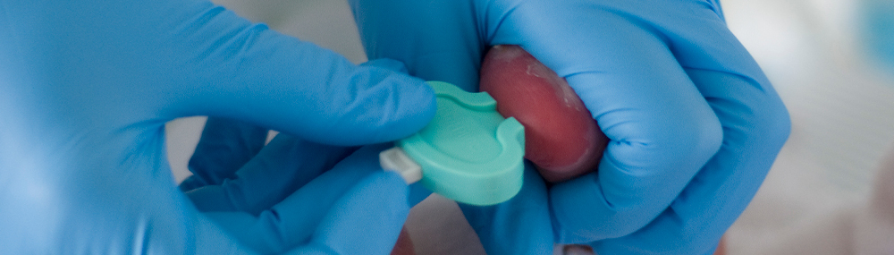 A medical professional wearing rubber gloves performs a newborn screening heel stick on a newborn baby’s foot. 