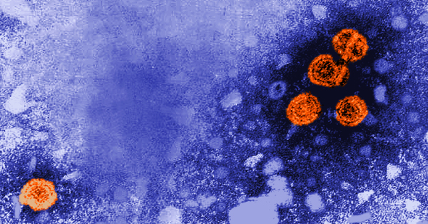 Microscopy image of hepatitis B virus particles, which are colored orange against a blue background.