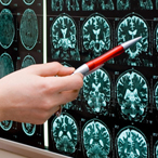 Person holding pen points at brain scans displayed on a light box on the wall.