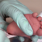 Blood is collected from a newborn for screening.