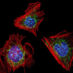 fibroblasts