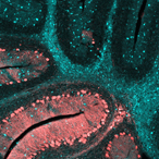 cerebellum of a mouse brain affected by NPC at the end stage of the disease