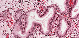 Stock image of endometrium