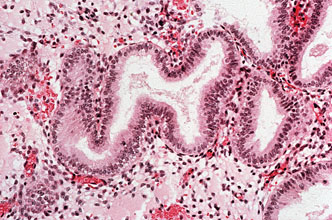 Cells of the endometrium dyed different shades of pink and purple.