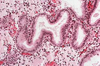 Stock image of endometrium