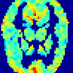 An fMRI image of brain activity after a volunteer read and thought about the word "love".