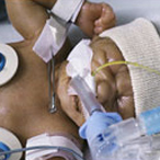 preterm baby