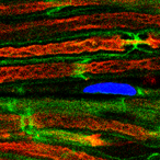 Fibrous sciatic nerves with axons (in red) wrapped by Schwann cells (in green) and their nuclei (in blue) 