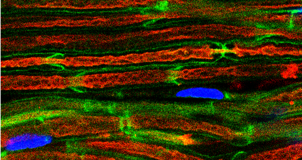 Microscopy image of sciatic nerves from control mice showing axons (red) wrapped by Schwann cells (green) with their nuclei depicted in blue.