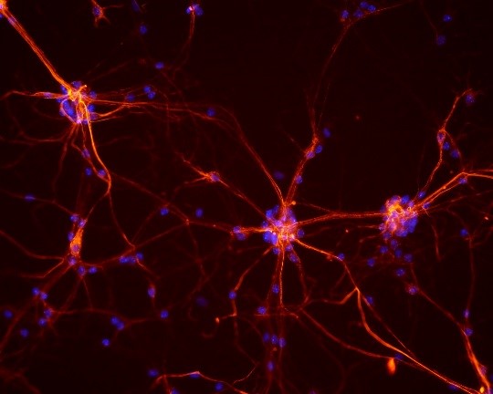 Mouse neurons 