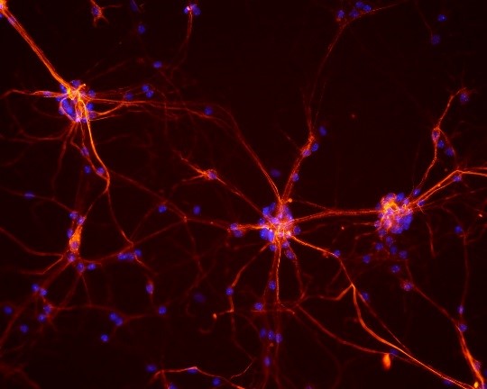 Microscopy image of mouse neurons.