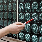 Person holding pen points at brain scans displayed on a light box on the wall.