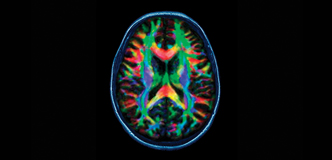 Stock image of a brain scan