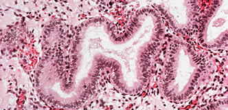 microscopic view of the endometrium