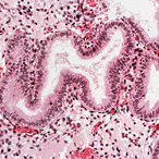 Microscopic view of the endometrium