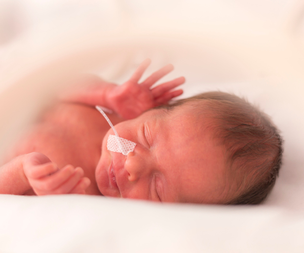 Image of a premature newborn baby in a hospital incubator