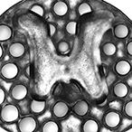 A 3D printed implant serving as scaffolding to repair spinal cord injury in rats. The roughly circular implant has an H shaped core surrounded by dots—conduits through which nerve fibers can grow. Credit: Jacob Koffler and Wei Zhu, University of California, San Diego.