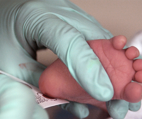 Newborn screening.