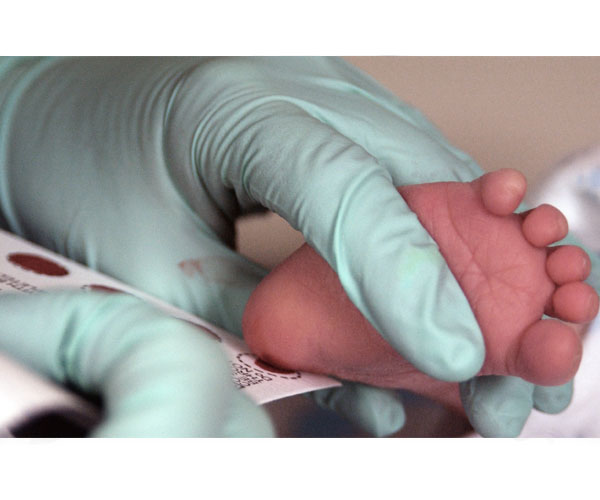 Newborn screening.