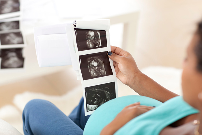 Pregnant woman looking at printout of pregnancy scans.