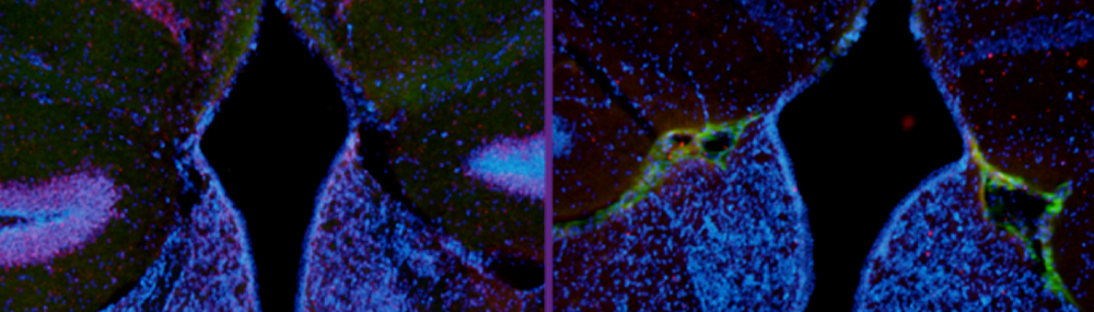 Fluorescent sections from mouse brains.