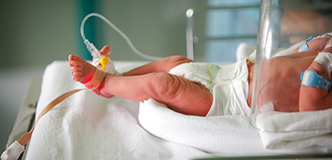 Preterm infant on a hospital table, wearing oxygen sensor, attached to an intravenous tube.