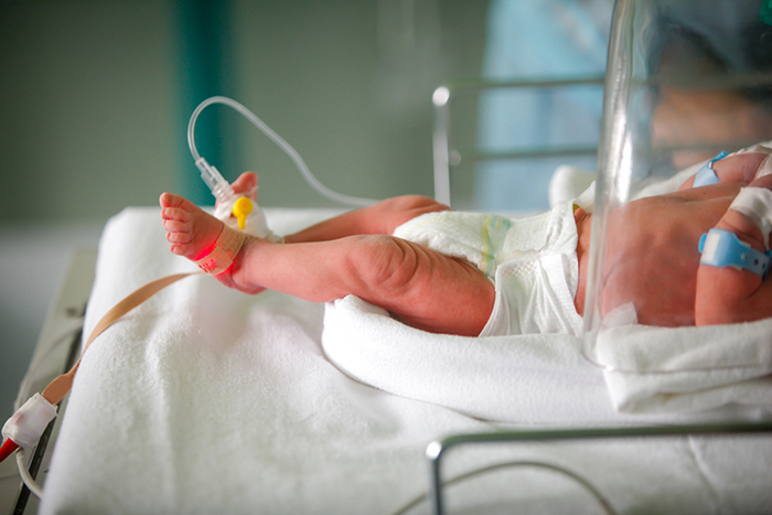 Preterm infant on a hospital table, wearing oxygen sensor, attached to an intravenous tube.