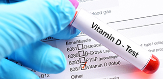 A gloved hand holds a test tube marked “Vitamin D Test,” in front of a check list of medical tests, with the box for “Vitamin D Test” checked.