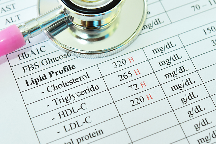 A stethoscope rests on top of a listing of the different kinds of cholesterol.