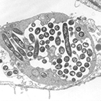 The dark oblong shapes in this image are Legionella bacteria, which causes Legionnaires' disease. 