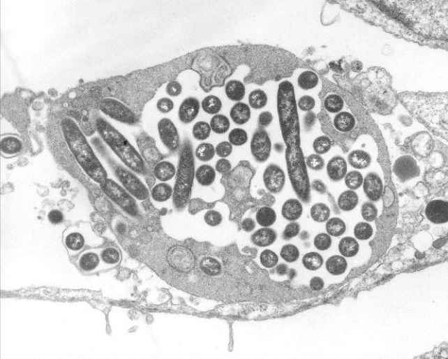 The dark oblong shapes in this image are Legionella bacteria, which causes Legionnaires' disease. 