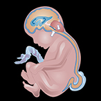 Side view of a fetus with a myelomeningocele protrusion in the lower spine