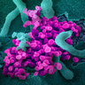 Scanning electron microscope image shows SARS-CoV-2 (round magenta objects) emerging from the surface of cells cultured in the lab.