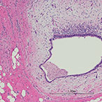 Microscopic image of endometrial cells.