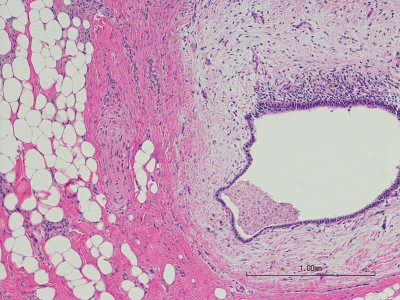 Microscopic image of endometrial cells.