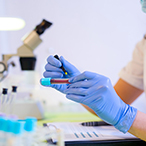 A lab worker labels a vial of blood amidst rows of empty test tubes and a microscope.