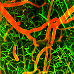Microscopy image with blood vessels marked in fluorescent red and green.