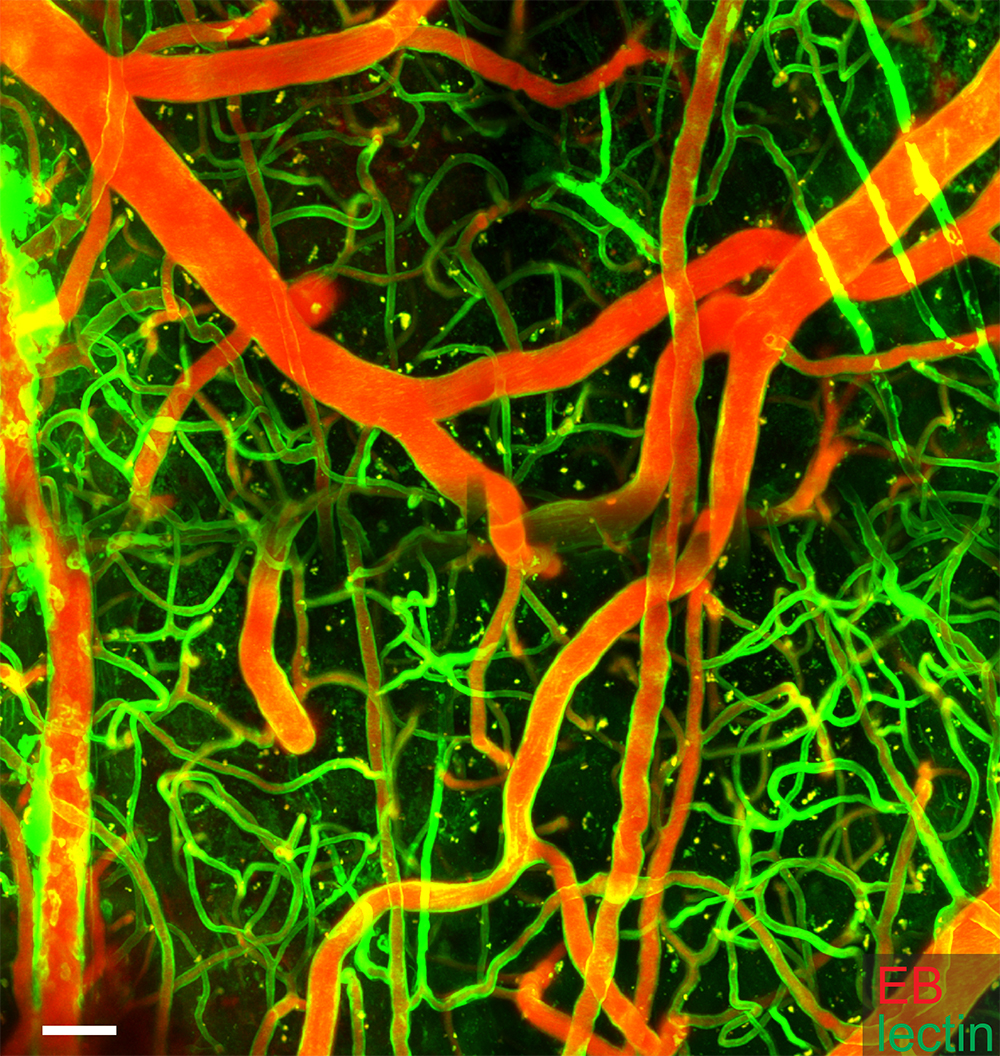 Microscopy image with blood vessels marked in fluorescent red and green.