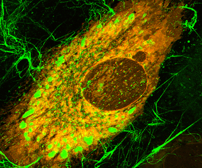 Microscopy image of a brown-colored cell with a large nucleus, green filaments around the exterior of the cell, and green clusters inside the cell.