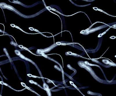 Artist’s rendition of swimming sperm with long tails (blue/white against a black background).