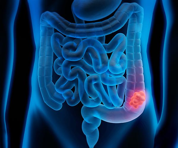 Artist’s rendition of the gastrointestinal system, with the colon highlighted in red.