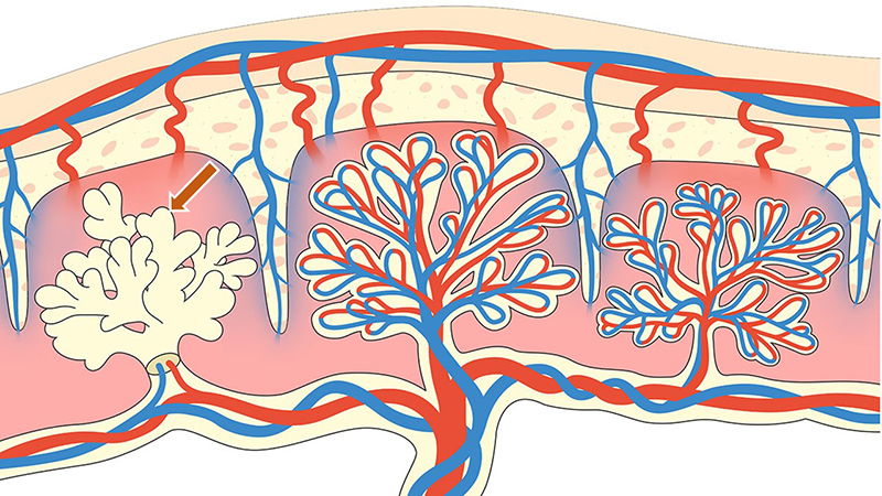 Diagram of the maternal and fetal parts of the placenta, showing the location of trophoblasts.