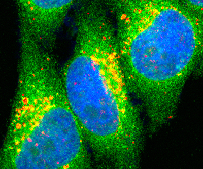 A cluster of four cells is visible against a black background. The cells are marked with blue, green, yellow, and red colors.