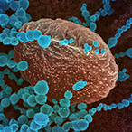 Small viral particles are colorized against a cellular background.